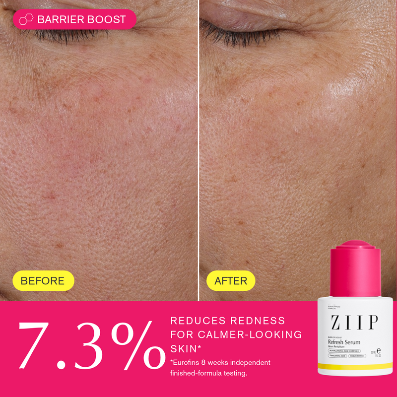 ZIIP Refresh Sérum + Ácido Tranexámico